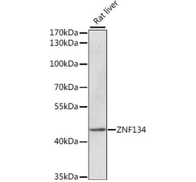 Western Blot - Anti-ZNF134 Antibody (A89949) - Antibodies.com