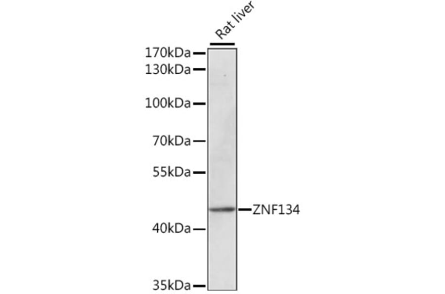 Western Blot - Anti-ZNF134 Antibody (A89949) - Antibodies.com