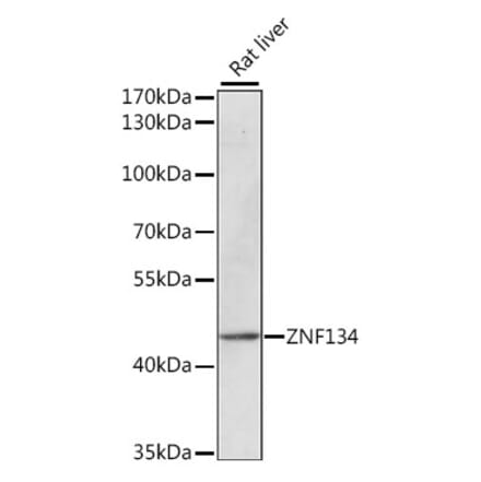 Western Blot - Anti-ZNF134 Antibody (A89949) - Antibodies.com