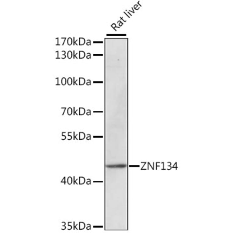 Western Blot - Anti-ZNF134 Antibody (A89949) - Antibodies.com