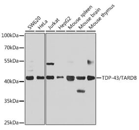 Western Blot - Anti-TDP43 Antibody (A89950) - Antibodies.com