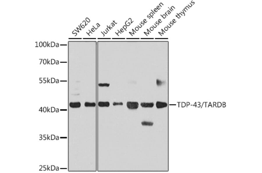 Western Blot - Anti-TDP43 Antibody (A89950) - Antibodies.com