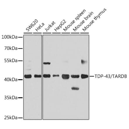 Western Blot - Anti-TDP43 Antibody (A89950) - Antibodies.com