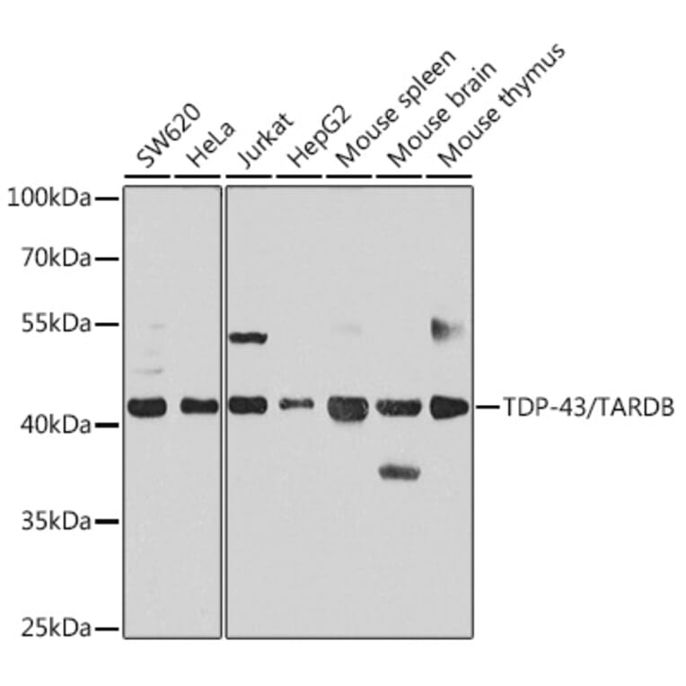 Western Blot - Anti-TDP43 Antibody (A89950) - Antibodies.com