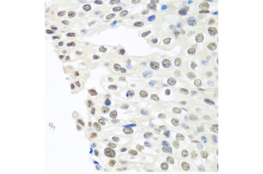 Immunohistochemistry - Anti-TDP43 Antibody (A89950) - Antibodies.com