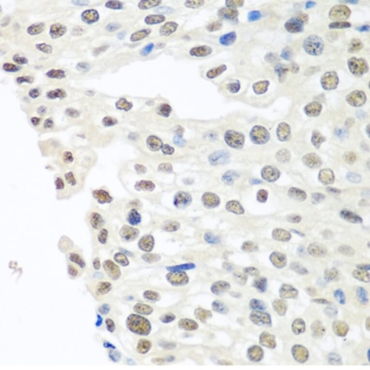 Immunohistochemistry - Anti-TDP43 Antibody (A89950) - Antibodies.com