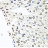 Immunohistochemistry - Anti-TDP43 Antibody (A89950) - Antibodies.com