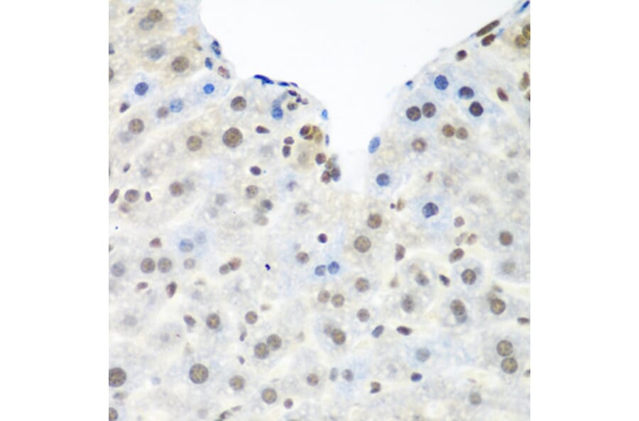Immunohistochemistry - Anti-TDP43 Antibody (A89950) - Antibodies.com