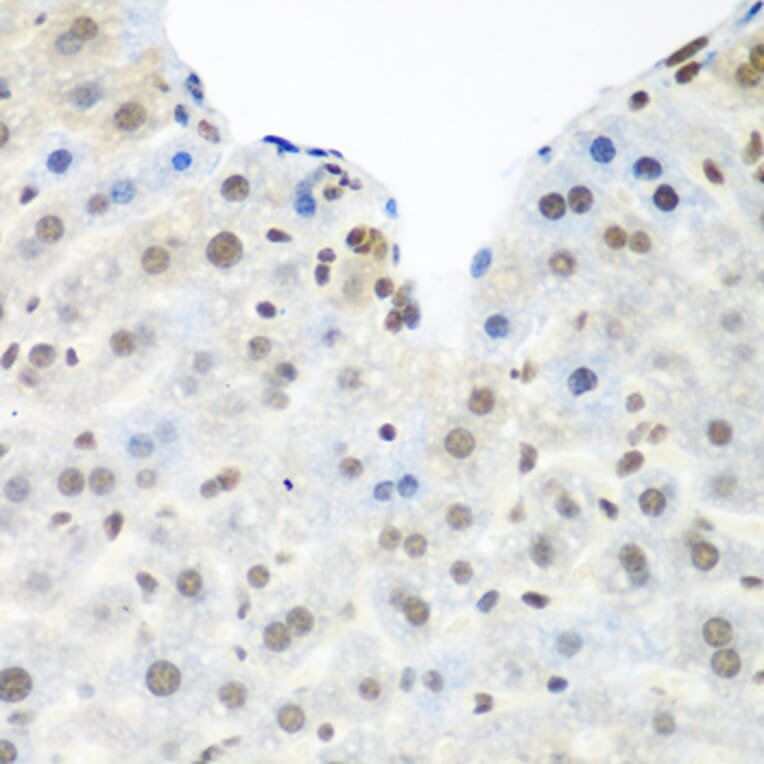 Immunohistochemistry - Anti-TDP43 Antibody (A89950) - Antibodies.com