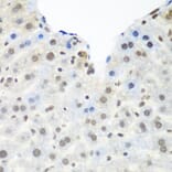 Immunohistochemistry - Anti-TDP43 Antibody (A89950) - Antibodies.com