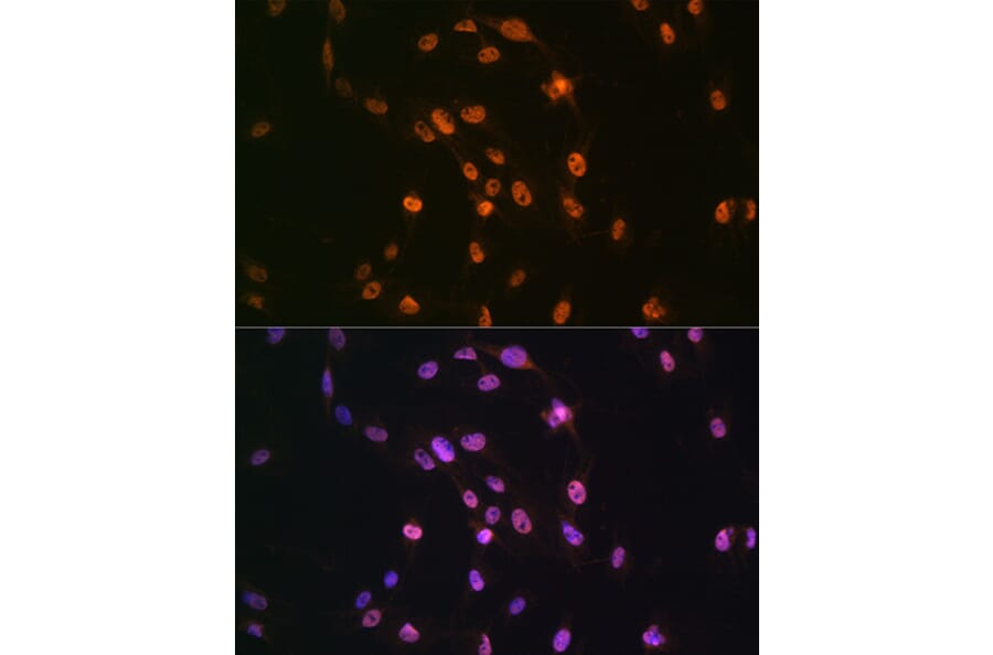 Immunofluorescence - Anti-TDP43 Antibody (A89950) - Antibodies.com