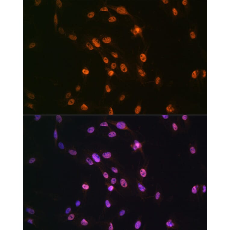 Immunofluorescence - Anti-TDP43 Antibody (A89950) - Antibodies.com