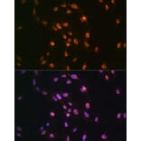 Immunofluorescence - Anti-TDP43 Antibody (A89950) - Antibodies.com