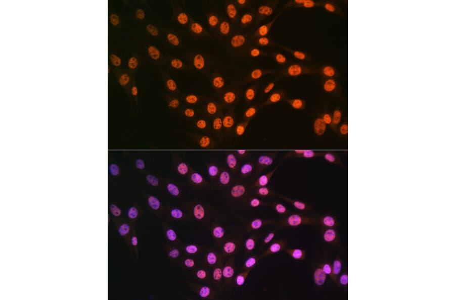 Immunofluorescence - Anti-TDP43 Antibody (A89950) - Antibodies.com
