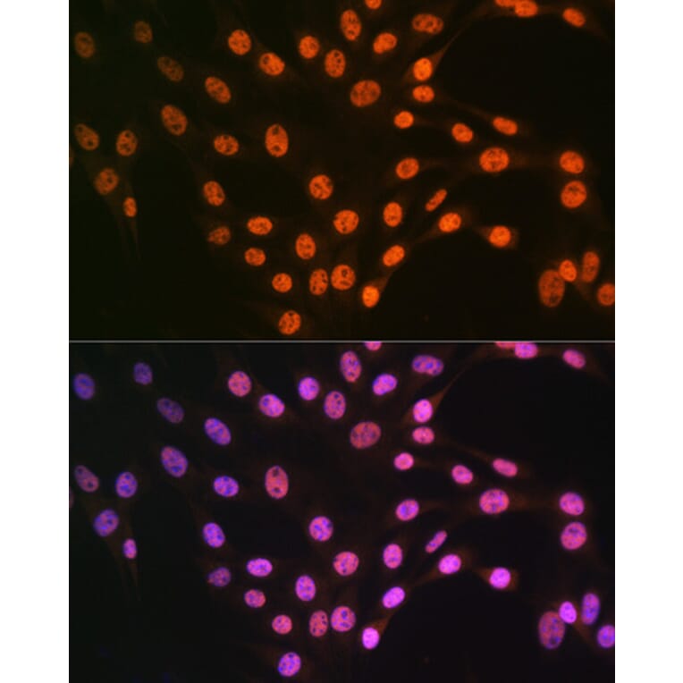 Immunofluorescence - Anti-TDP43 Antibody (A89950) - Antibodies.com