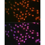 Immunofluorescence - Anti-TDP43 Antibody (A89950) - Antibodies.com