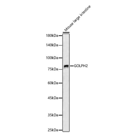 Western Blot - Anti-GOLPH2 Antibody (A89951) - Antibodies.com