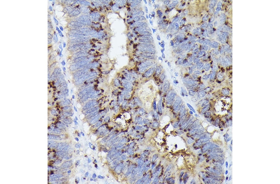 Immunohistochemistry - Anti-GOLPH2 Antibody (A89951) - Antibodies.com