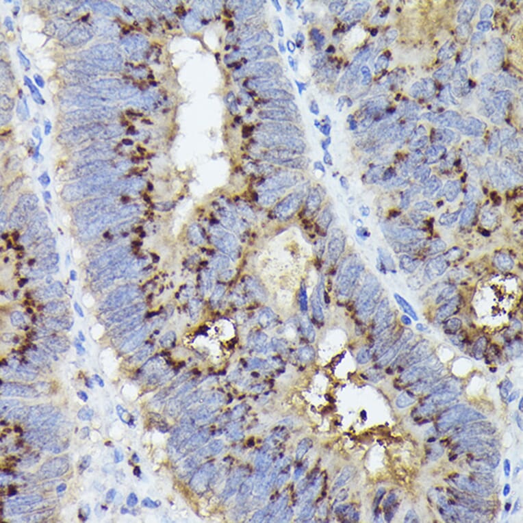 Immunohistochemistry - Anti-GOLPH2 Antibody (A89951) - Antibodies.com
