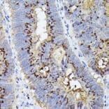 Immunohistochemistry - Anti-GOLPH2 Antibody (A89951) - Antibodies.com