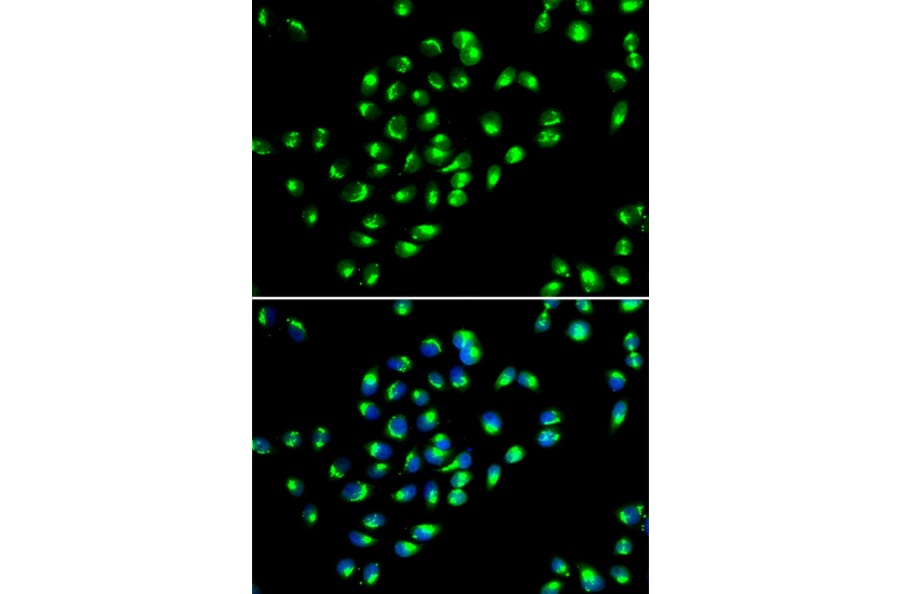Immunofluorescence - Anti-GOLPH2 Antibody (A89951) - Antibodies.com