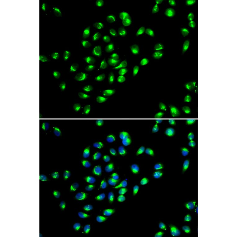 Immunofluorescence - Anti-GOLPH2 Antibody (A89951) - Antibodies.com
