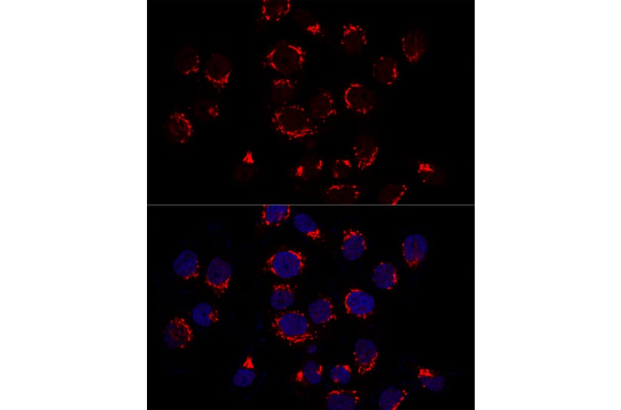 Immunofluorescence - Anti-GOLPH2 Antibody (A89951) - Antibodies.com