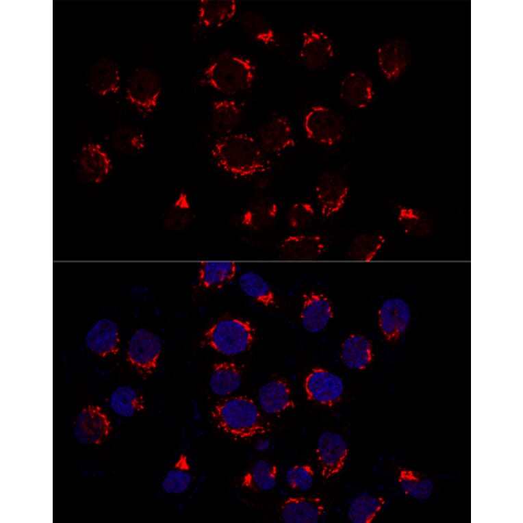 Immunofluorescence - Anti-GOLPH2 Antibody (A89951) - Antibodies.com