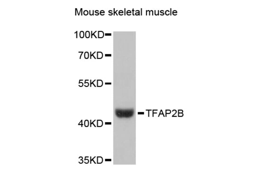 Western Blot - Anti-TFAP2B Antibody (A13885) - Antibodies.com