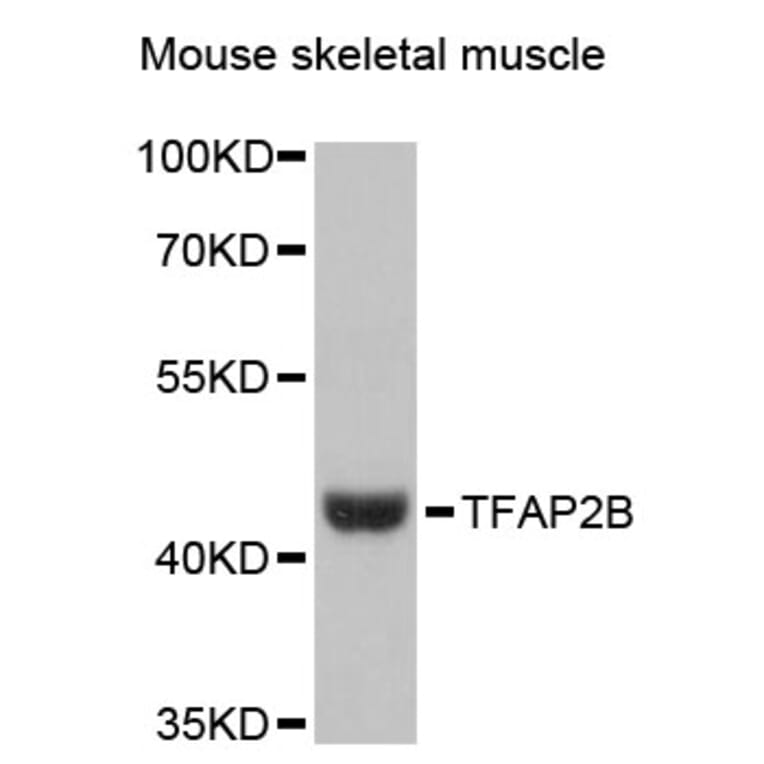 Western Blot - Anti-TFAP2B Antibody (A13885) - Antibodies.com