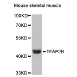 Western Blot - Anti-TFAP2B Antibody (A13885) - Antibodies.com