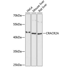 Western Blot - Anti-CRACR2A Antibody (A89954) - Antibodies.com