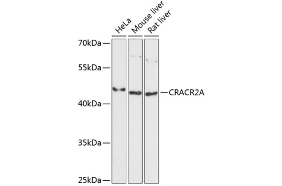 Western Blot - Anti-CRACR2A Antibody (A89954) - Antibodies.com
