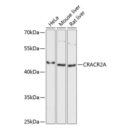 Western Blot - Anti-CRACR2A Antibody (A89954) - Antibodies.com