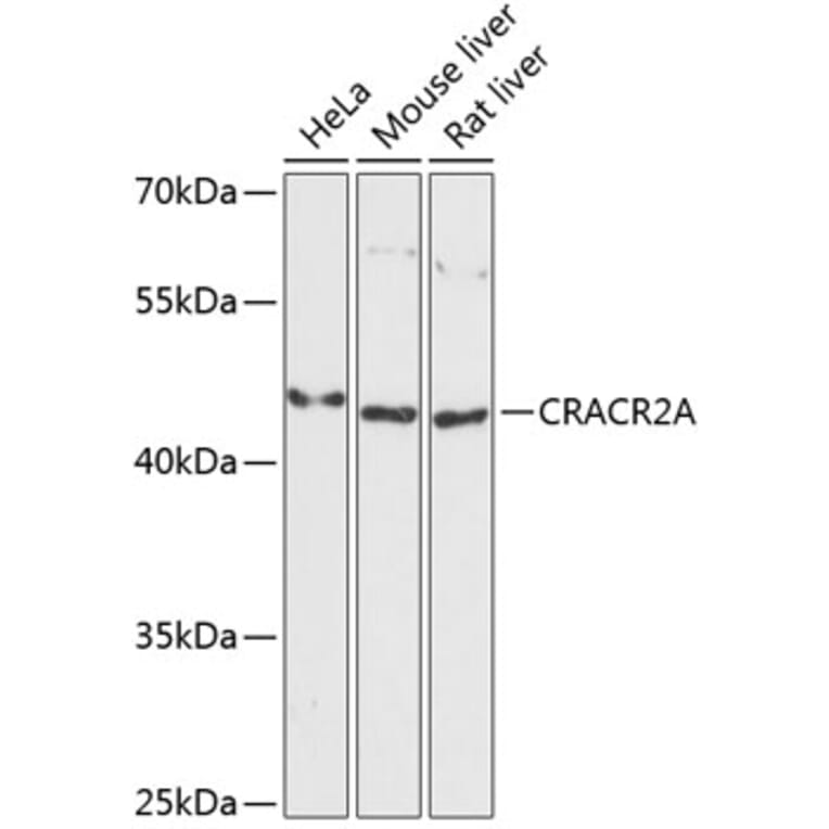 Western Blot - Anti-CRACR2A Antibody (A89954) - Antibodies.com