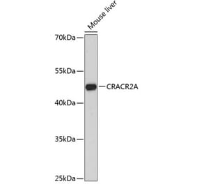 Western Blot - Anti-CRACR2A Antibody (A89955) - Antibodies.com