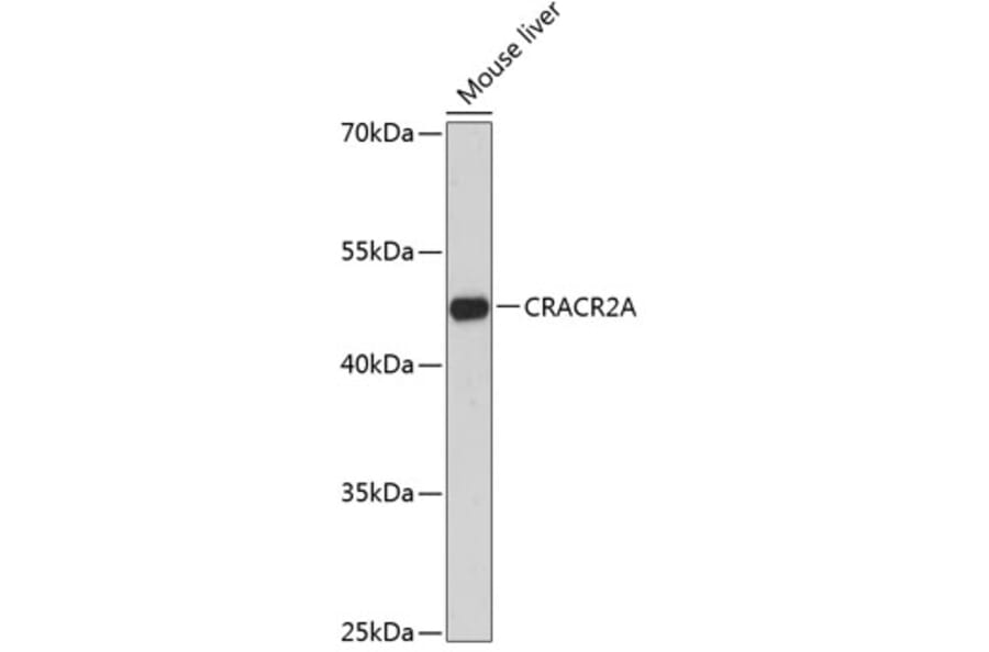 Western Blot - Anti-CRACR2A Antibody (A89955) - Antibodies.com