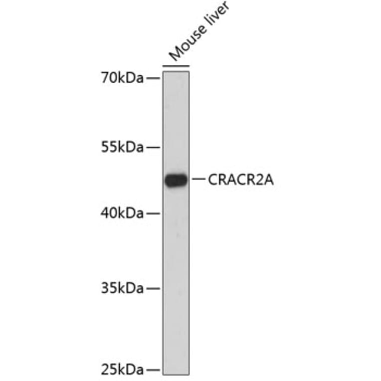 Western Blot - Anti-CRACR2A Antibody (A89955) - Antibodies.com
