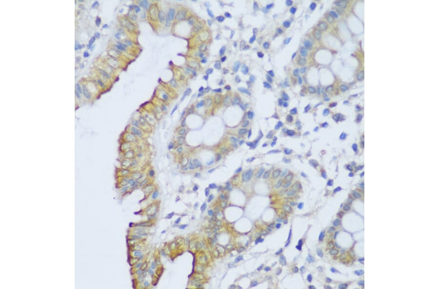 Immunohistochemistry - Anti-CRACR2A Antibody (A89955) - Antibodies.com
