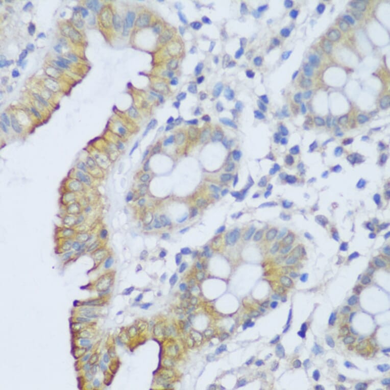 Immunohistochemistry - Anti-CRACR2A Antibody (A89955) - Antibodies.com