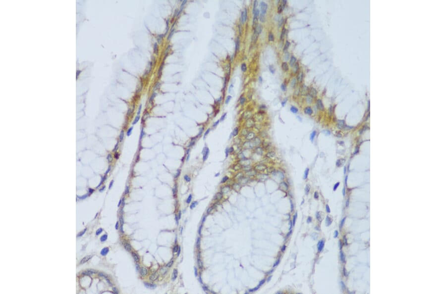 Immunohistochemistry - Anti-CRACR2A Antibody (A89955) - Antibodies.com