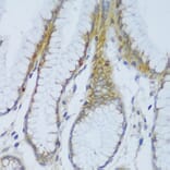 Immunohistochemistry - Anti-CRACR2A Antibody (A89955) - Antibodies.com