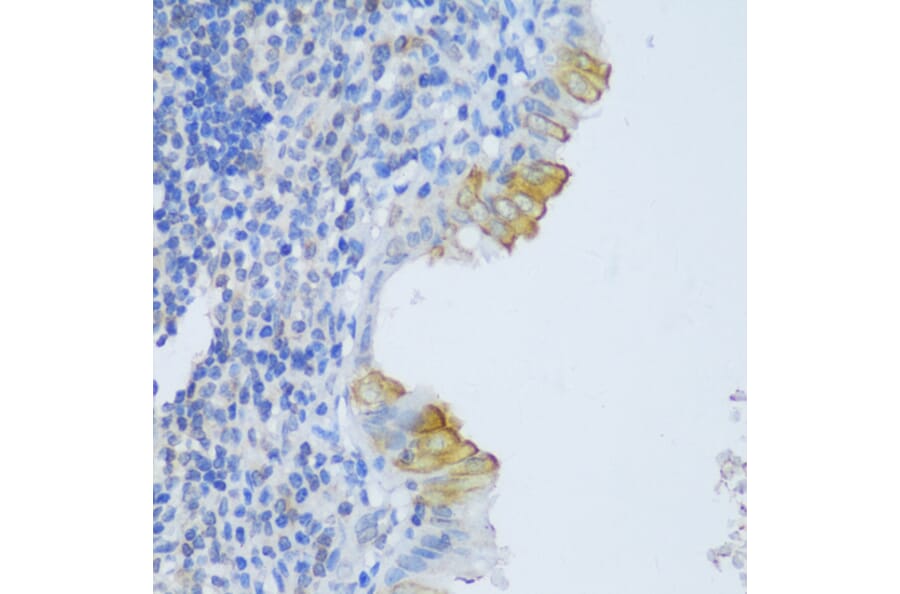 Immunohistochemistry - Anti-CRACR2A Antibody (A89955) - Antibodies.com