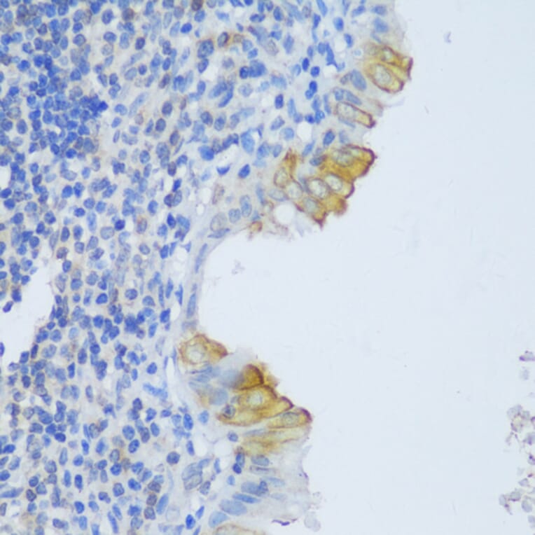 Immunohistochemistry - Anti-CRACR2A Antibody (A89955) - Antibodies.com