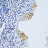 Immunohistochemistry - Anti-CRACR2A Antibody (A89955) - Antibodies.com