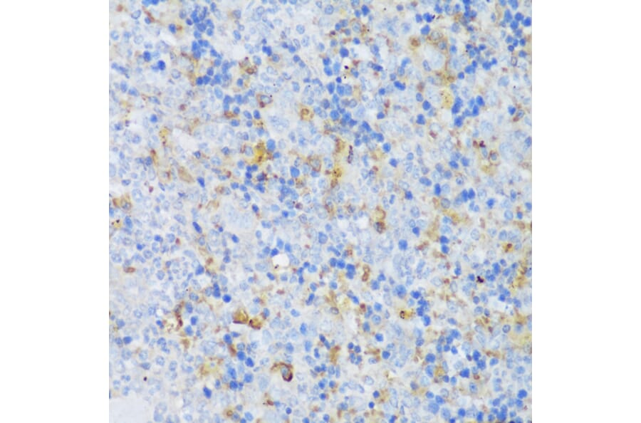 Immunohistochemistry - Anti-CRACR2A Antibody (A89955) - Antibodies.com