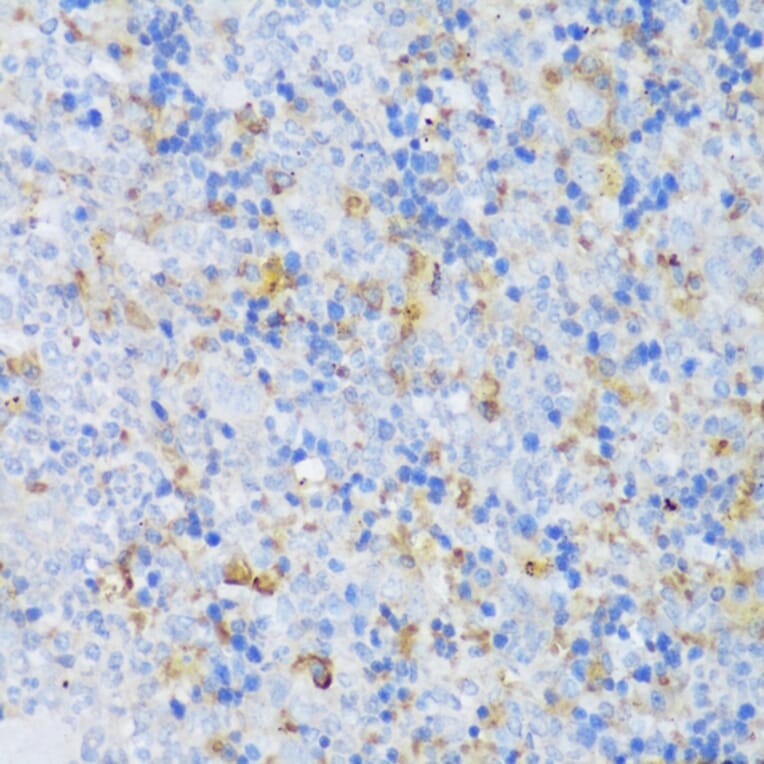 Immunohistochemistry - Anti-CRACR2A Antibody (A89955) - Antibodies.com