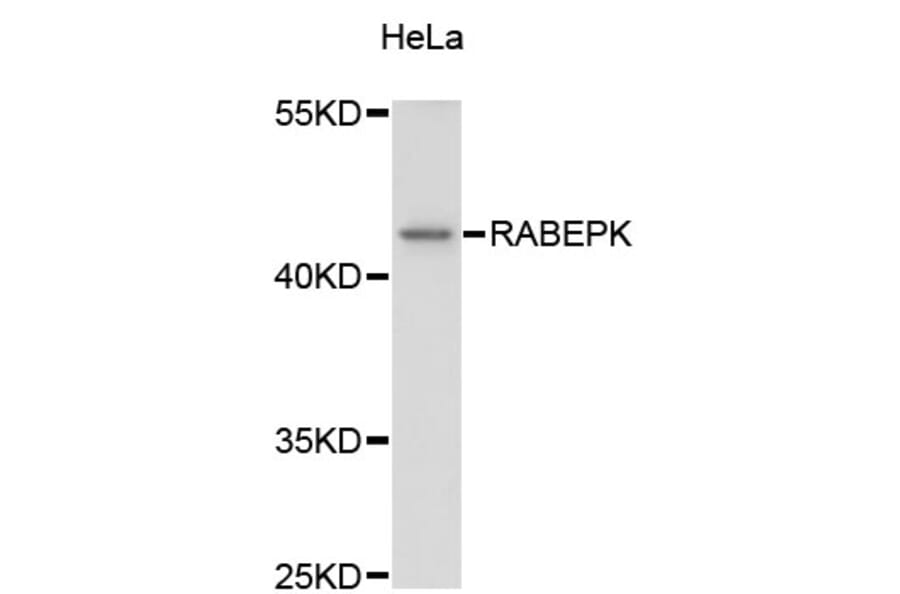 Western Blot - Anti-RABEPK Antibody (A4391) - Antibodies.com