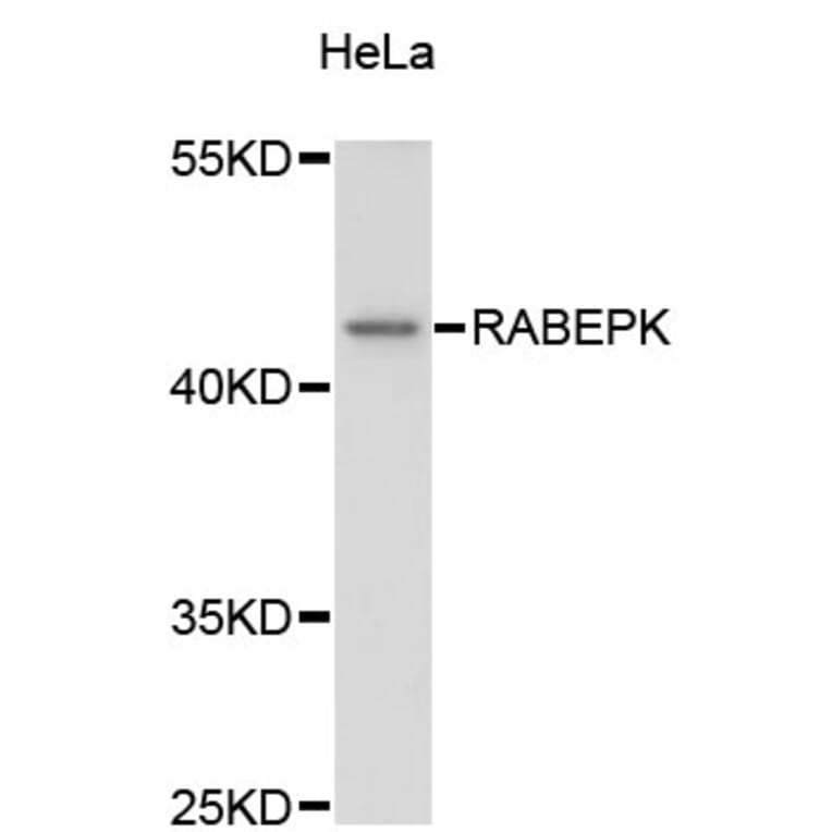 Western Blot - Anti-RABEPK Antibody (A4391) - Antibodies.com