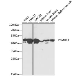Western Blot - Anti-PSMD13 Antibody (A89957) - Antibodies.com